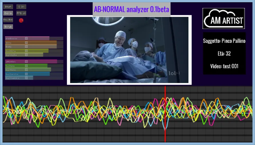 AB-Normal Analyzer
